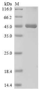 ATP-dependent translocase ABCB1 (ABCB1), partial, human, recombinant
