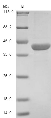 Beta-amylase 1, chloroplastic (BAM1),partial, Arabidopsis thaliana, recombinant