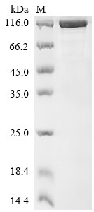 Nuclear pore complex protein Nup85 (NUP85), human, recombinant