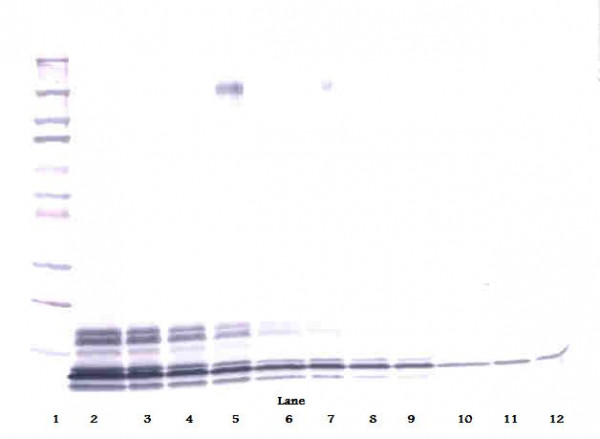 Anti-CXCL7 / NAP-2