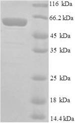E3 ubiquitin-protein ligase Mdm2 (Mdm2), mouse, recombinant