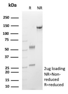 Anti-IGHE / Immunoglobulin heavy constant epsilon, clone rIGHE/13128
