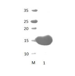 PSMD9 PDZ Domain
