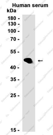 Anti-Recombinant LRG1, clone C322894