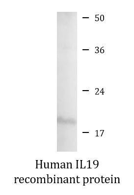 Human IL19 recombinant protein (Active)