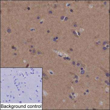 Anti-HMGCR