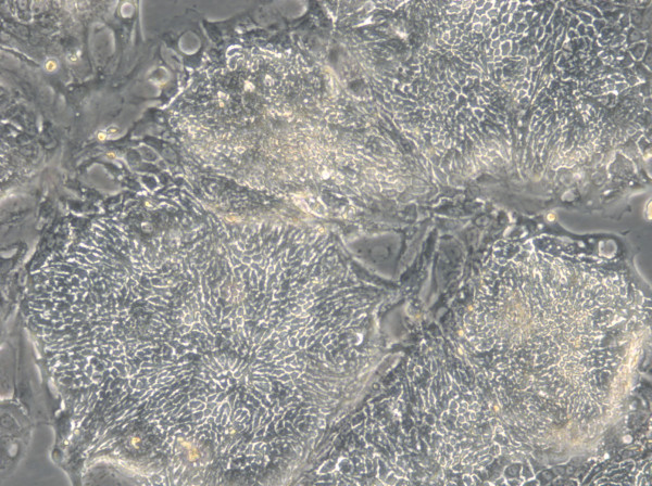 HROC103 T0 M1 Cells