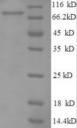 E3 ubiquitin-protein ligase RAD18 (RAD18), human, recombinant