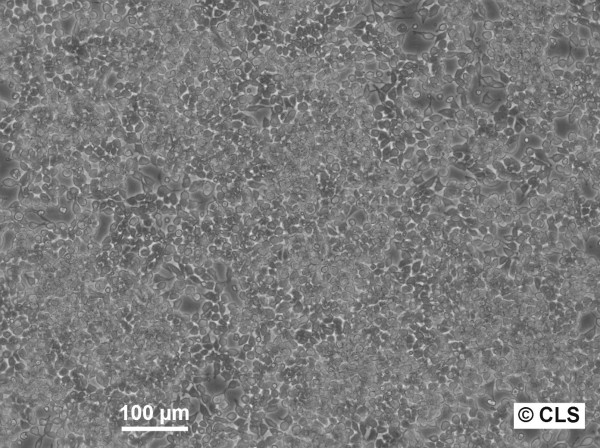 SK-UT-1B Cells