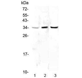 Anti-PPCS / Phosphopantothenoylcysteine synthetase