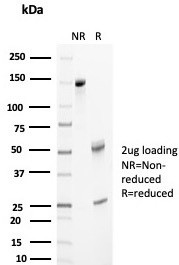 Anti-APO-J / Apolipoprotein J / Clusterin, clone CLU/4733