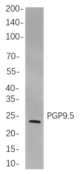 Anti-Recombinant PGP9.5, clone 6C5