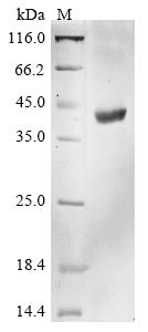 HLA class I histocompatibility antigen, A alpha chain (HLA-A),partial, human, recombinant