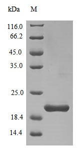 Envelope small membrane protein &amp; Membrane protein (E &amp; M), partial, Severe acute respiratory syndro