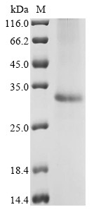 Mitochondrial glutamate carrier 2 (Slc25a18), rat, recombinant