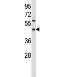 Anti-PDCD4