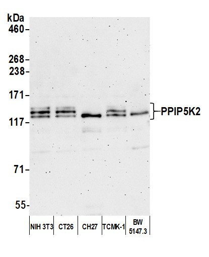 Anti-PPIP5K2