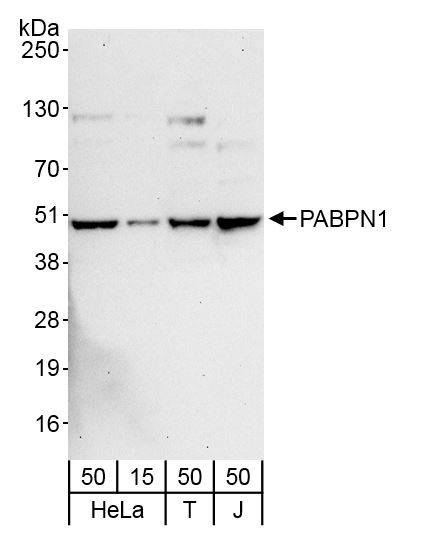 Anti-PABPN1