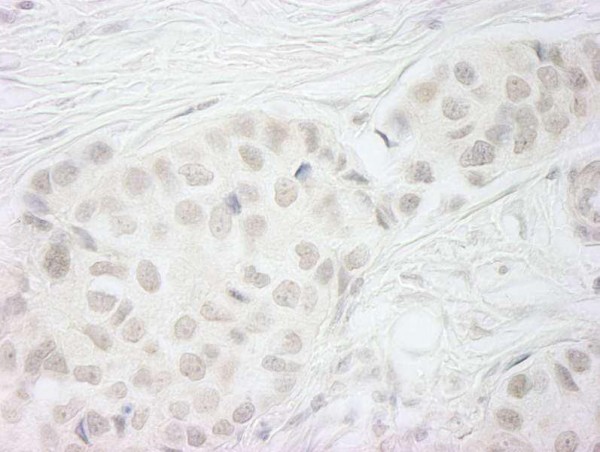 Anti-BubR1 (IHC)