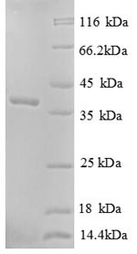Soluble calcium-activated nucleotidase 1 (CANT1), partial, human, recombinant
