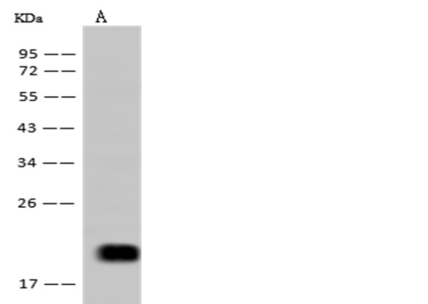 Anti-IL-5 Monoclonal Recombinant Antibody