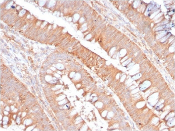 Anti-CD59, clone MACIF/2867R