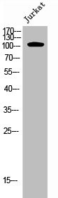 Anti-Phospho-EPHA7 (Y791)