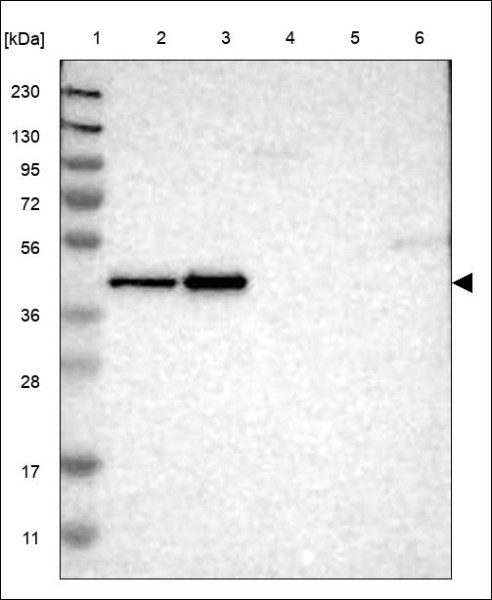 Anti-TRIB3