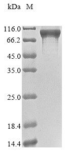Signal recognition particle subunit SRP72 (SRP72), human, recombinant