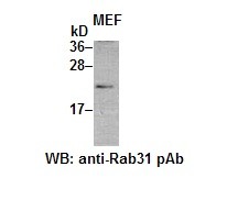 Anti-Rab31