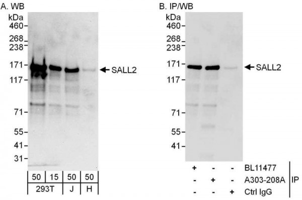 Anti-SALL2