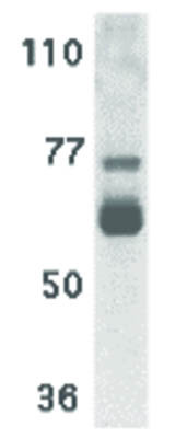 Anti-IL-22 Receptor