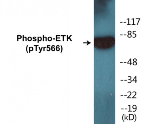 ETK (Phospho-Tyr566) Colorimetric Cell-Based ELISA Kit