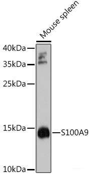 Anti-S100A9