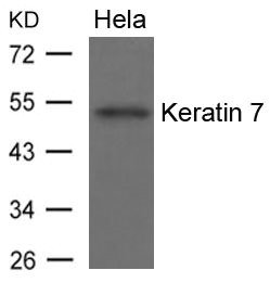 Anti-KRT7