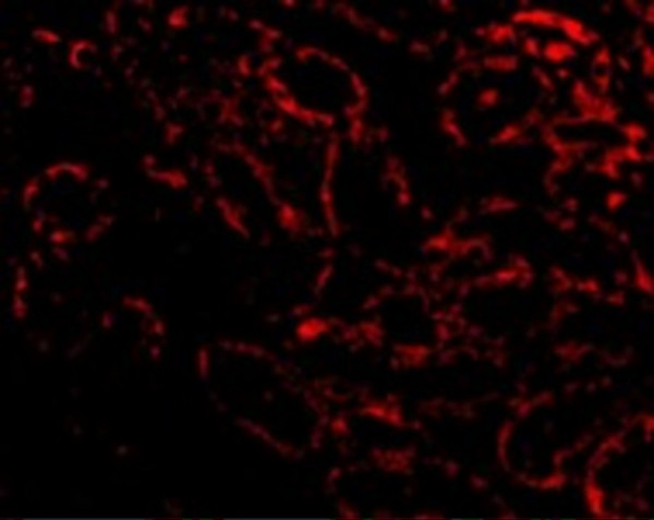 Necrosome Antibody Panel