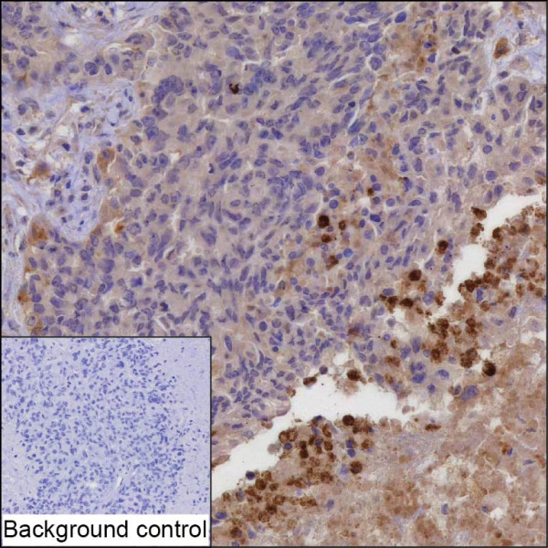 Anti-MMP9