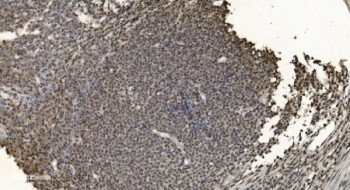 Anti-hnRNP H3 / HNRNPH3
