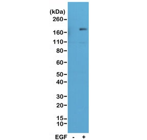Anti-phospho-EGFR (Tyr1173), clone RM269 (recombinant antibody)