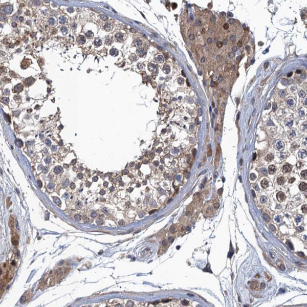 Anti-MDM1