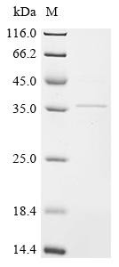 Troponin T, cardiac muscle (Tnnt2), rat, recombinant