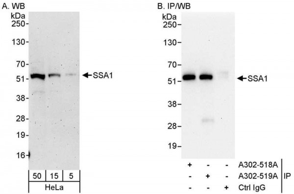 Anti-SSA1