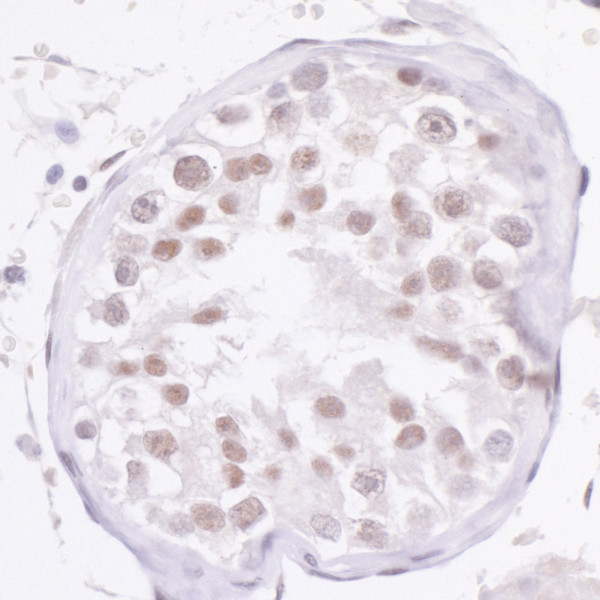 Anti-NCOA2/SRC2