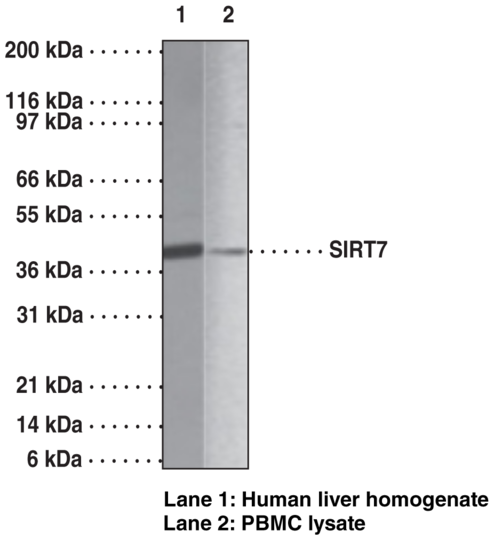 Anti-SIRT7