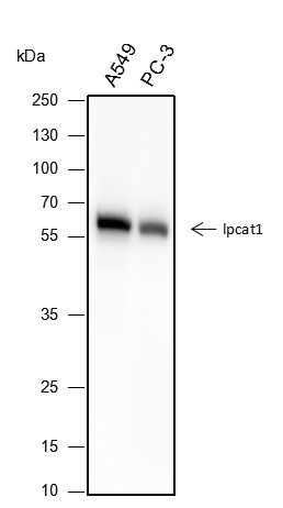Anti-Recombinant LPCAT1, clone A287
