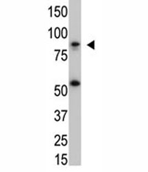 Anti-IKK beta, clone 62AT992