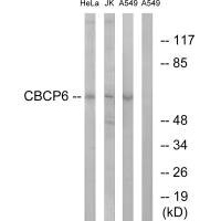 Anti-AGBL4