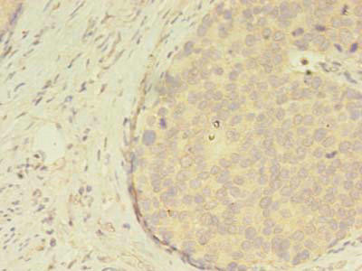 Anti-ATXN7L3