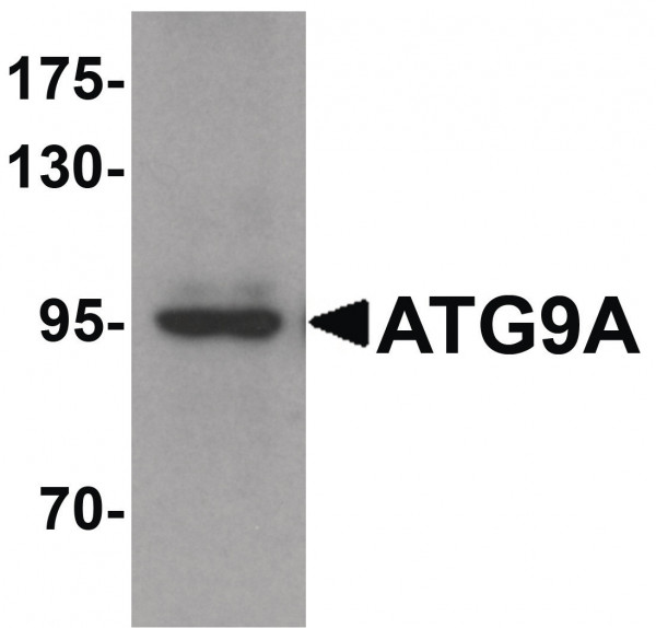 Anti-ATG9A