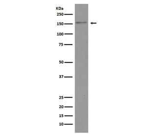 Anti-Brd4, clone DBH-2